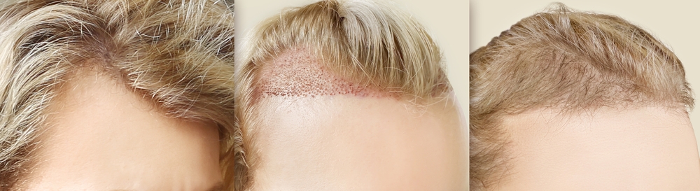 Hur paketpriser och flera behandlingar påverkar kostnaden hos 85 Kliniken